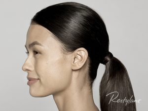 Efter behandling af rynker med filler