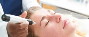Microneedling med dermapen